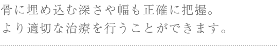 3次元で確認できるＣＴ撮影機 