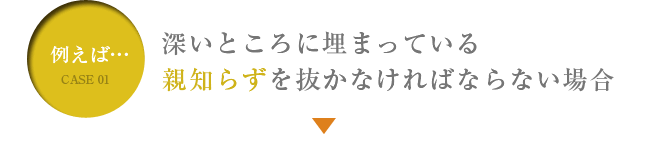 3次元で確認できるＣＴ撮影機 