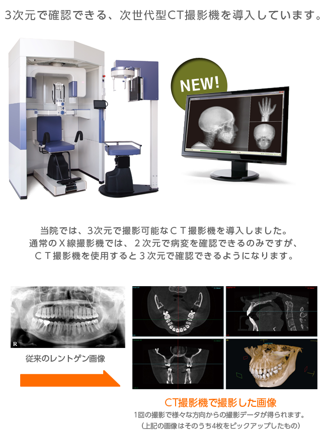 3次元で確認できるＣＴ撮影機 