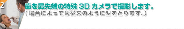 歯を最先端の特殊3Dカメラで撮影します。（場合によってはじゅうらいのように型をとります。）